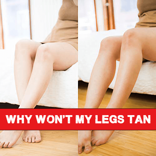 Why Won't My Legs Tan
