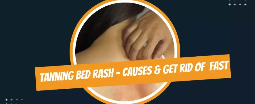 tanning bed rash